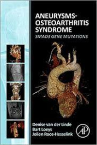 Aneurysms-Osteoarthritis Syndrome: Smad3 Gene Mutations