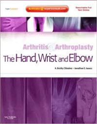 Arthritis & Arthroplasty: The Hand, Wrist and Elbow