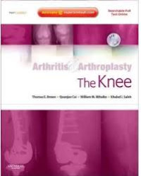 Arthritis & Arthroplasty: The Knee