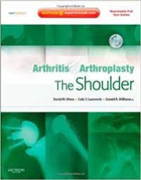 Arthritis & Arthroplasty: The Shoulder