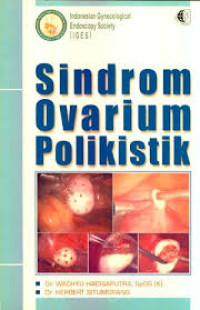 Sindrom Ovarium Polikistik