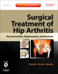 Surgical Treatment Of Hip Arthritis: Reconstruction, Replacement, and Revision